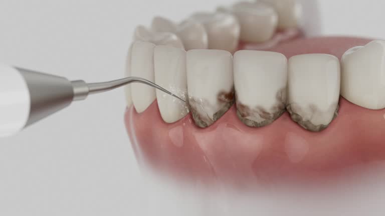 Trusted Dental Implants service in Sea Bright, NJ - Dentist Open Now